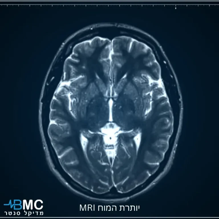 MRI יותרת המוח – הדמיית מוח לאבחון אדנומות והפרעות הורמונליות