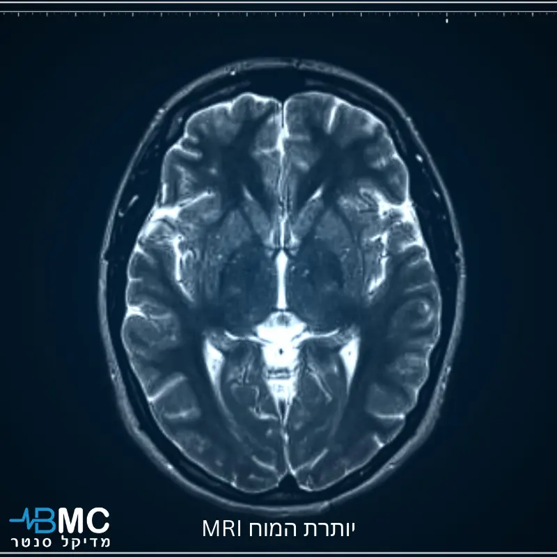 MRI יותרת המוח – הדמיית מוח לאבחון אדנומות והפרעות הורמונליות