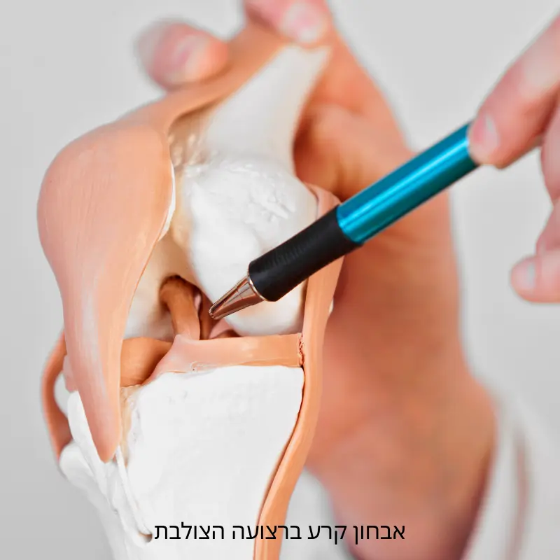 אבחון קרע ברצועה הצולבת - BMC מדיקל סנטר