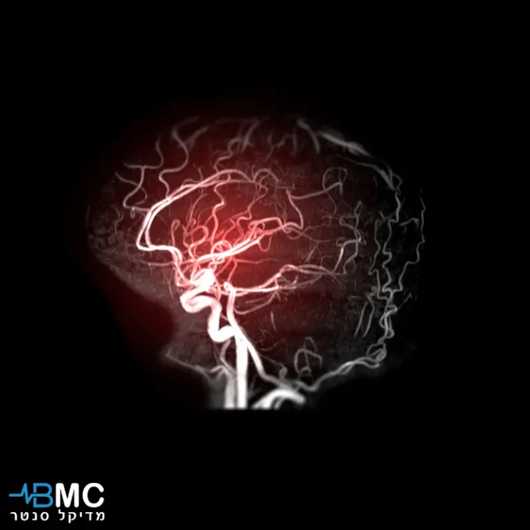 בדיקת MRA במרכז הרפואי של BMC מדיקל סנטר