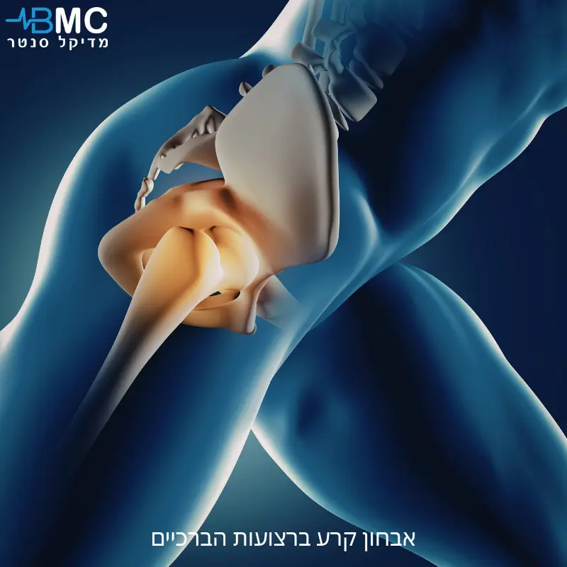 קרע ברצועות הברך והדמיה של מפרק הברך